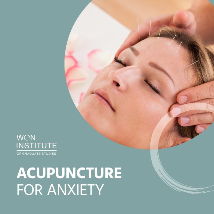 Acupuncture anxiety